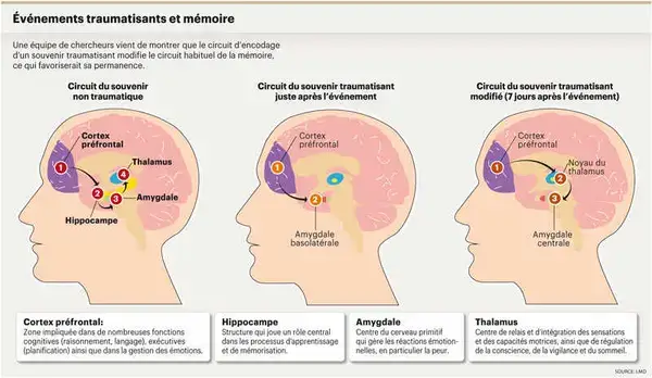 Schéma du cerveau suite à traumatisme